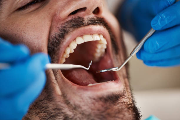 Best Broken or Chipped Tooth Repair in Kilgore, TX